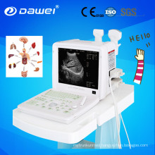 Chison 2D portable ultrasound machine price